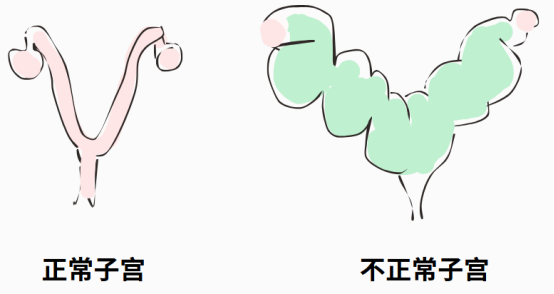 狗狗子宫蓄脓