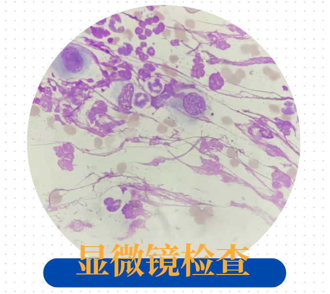 猫癣怎么区分