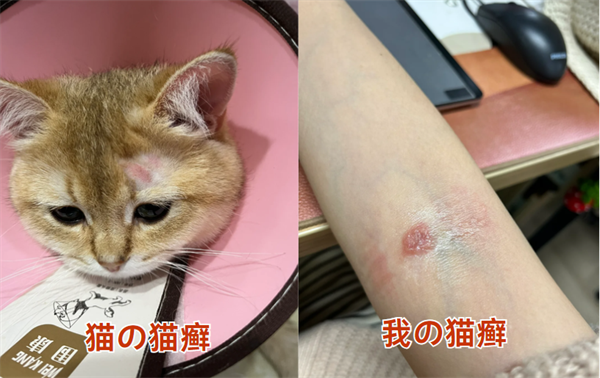 猫癣症状