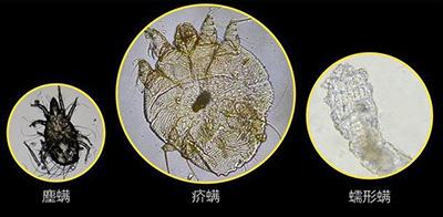 如何有效治疗小狗螨虫皮肤病？