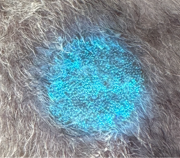 猫癣怎么诊断？