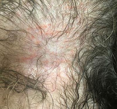 狗狗大腿內側有紅疹子，究竟是什麼東西？
