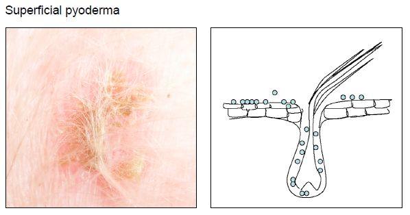 浅表性脓皮症