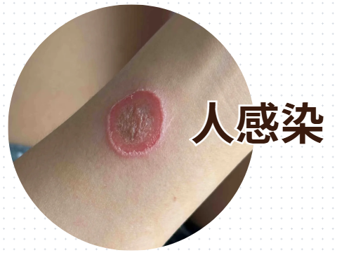 狗狗長癬怎么治？